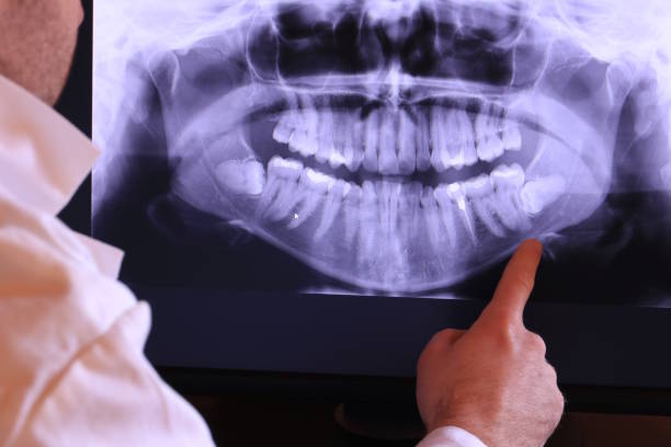 Best Emergency Dentist for Knocked-Out Tooth in Glendora, NJ
