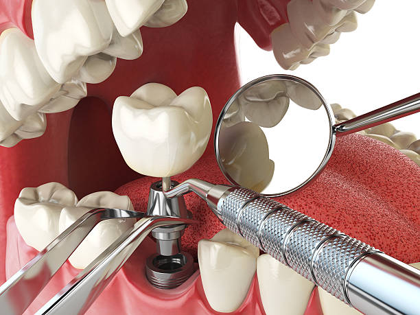 Best Broken or Cracked Tooth Emergency Dentist in Glendora, NJ